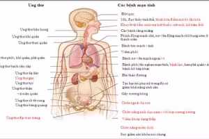 Các bệnh do sử dụng sản phẩm thuốc lá truyền thống gây ra. Ảnh chụp từ tài liệu hướng dẫn của Bộ GD&ĐT.