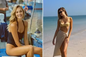Nàng WAG siêu mẫu có nụ cười đẹp nhất thế giới 