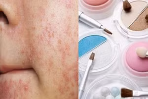 Các mỹ phẩm ""đại kỵ" với nhau, chớ dại dùng chung 