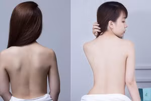 Hai cách tắm trắng da an toàn với quả cam