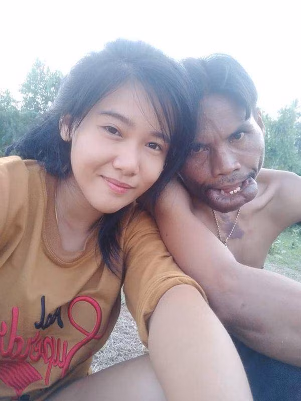 Cuộc sống không như mơ của anh chàng mặt quỷ sau 3 năm lấy vợ xinh đẹp-2