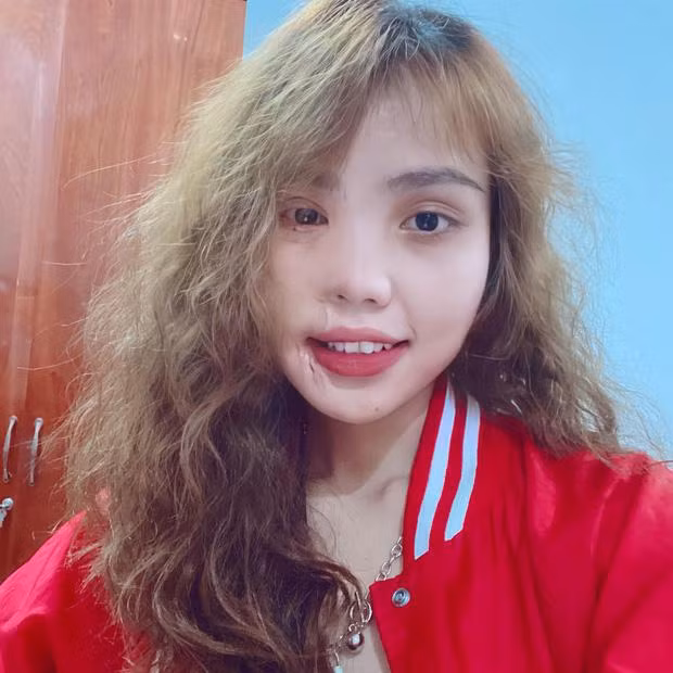 Bất ngờ ngoại hình cô gái Đà Nẵng bị chồng sắp cưới tạt axit, hủy nửa mặt-6