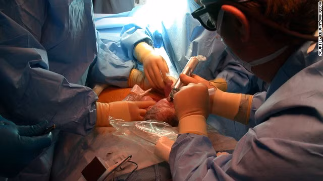 Phẫu thuật cho trẻ tránh các khuyết tật sau khi sinh mang nhiều rủi ro cao.