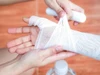 Bỏng xăng rất nguy hiểm do nhiệt độ cao và khả năng gây bỏng sâu. (Ảnh minh họa: ITN)