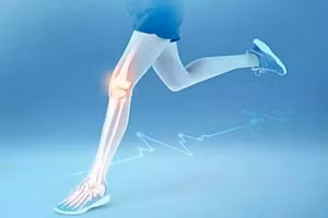 Bệnh nhân loãng xương dễ bị gãy xương, gây ảnh hưởng nghiêm trọng đến sức khỏe và cuộc sống. (Ảnh: ITN).