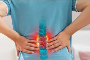Đau lưng dưới – Dấu hiệu cảnh báo bệnh gì?