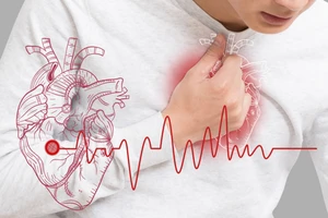 Chế độ ăn kiêng cực đoan cũng gây quá tải cho hệ tim mạch. (Ảnh: ITN)