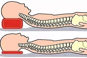 Sử dụng gối không đúng cách có thể gây ra nhiều tác hại cho cơ thể. (Ảnh: ITN)