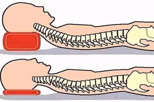 Sử dụng gối không đúng cách có thể gây ra nhiều tác hại cho cơ thể. (Ảnh: ITN)