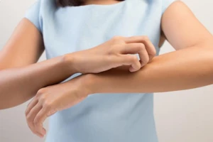 Cảm giác ngứa xuất hiện trên cơ thể thường bị mọi người hiểu lầm là vấn đề vệ sinh. (Ảnh: ITN)