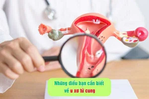 Những điều bạn cần biết về u xơ tử cung