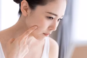 Da khô là sự khởi đầu của quá trình lão hóa. (Ảnh: ITN)