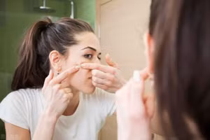 Ăn nhiều đường gây ra mụn trứng cá và viêm nhiễm. (Ảnh: ITN)