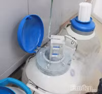 Hé lộ quy trình trữ đông tinh trùng tại bệnh viện không phải ai cũng biết ảnh 11 He lo quy trinh tru dong tinh trung tai benh vien khong phai ai cung biet - Anh 11