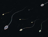  Giai ma nguyen nhan quy ong khong co tinh trung-Hinh-5 Tinh trùng sản xuất quá ít. Khi tinh hoàn suy giảm chức năng nặng và sản xuất rất ít tinh trùng. Tuy nhiên, khi sinh thiết tinh hoàn và có thể tìm thấy ít tinh trùng ở một số nơi trong tinh hoàn.