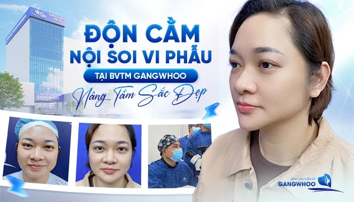 Độn cằm nội soi vi phẫu tại Bệnh viện thẩm mỹ Gangwhoo: Nâng tầm sắc đẹp và an toàn