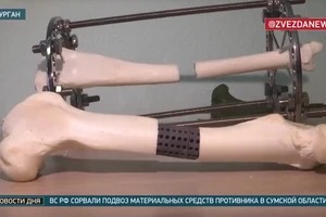 Công nghệ titan mới mở ra cách thay xương chưa từng có