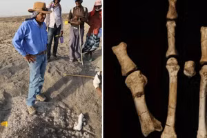 Haile-Selassie và nhóm của ông trên thực địa (trái). Chân Burtele với các bộ phận ở vị trí giải phẫu (phải).