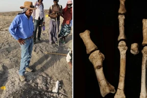 Haile-Selassie và nhóm của ông trên thực địa (trái). Chân Burtele với các bộ phận ở vị trí giải phẫu (phải).