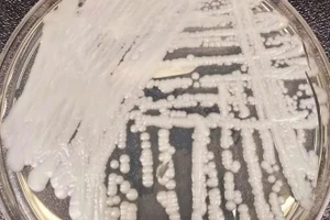 Siêu vi khuẩn lan rộng tại 27 bang Mỹ đây là nơi loại nấm gây chết người đang hoành hành.