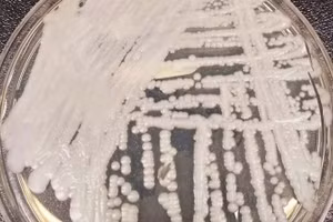 Siêu vi khuẩn lan rộng tại 27 bang Mỹ đây là nơi loại nấm gây chết người đang hoành hành.