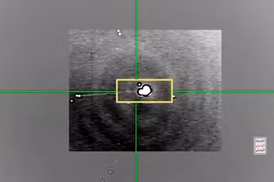 Video Houthi lại bắn hạ MQ-9 Mỹ giá 30 triệu USD ở Yemen