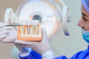 Chuyên gia nha khoa đang kiểm tra mô hình cấy ghép răng dưới ánh sáng phòng khám. (hình ảnh minh họa).