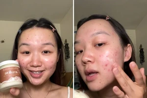 Daniela Martinez bắt đầu kết hợp hạt lanh vào quy trình chăm sóc da của mình sau khi xem video từ những phụ nữ trẻ khác ca ngợi lợi ích của hạt lanh. Ảnh: Daniela Martinez/CNN.
