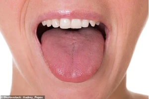 Một chiếc lưỡi khỏe mạnh có màu hồng với bề mặt hơi sần sùi. Việc để ý bất kỳ thay đổi nào có thể giúp phát hiện sớm các tình trạng sức khỏe.