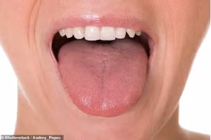 Một chiếc lưỡi khỏe mạnh có màu hồng với bề mặt hơi sần sùi. Việc để ý bất kỳ thay đổi nào có thể giúp phát hiện sớm các tình trạng sức khỏe.