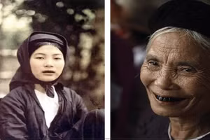 Phụ nữ Việt Nam với hàm răng đen. 