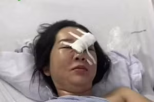 Chị Đỗ Thị Thảo đang điều trị tại bệnh viện với 2 vết thương ở vùng mặt và tay phải.
