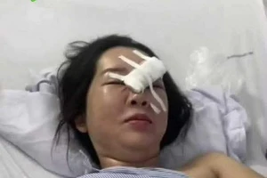 Chị Đỗ Thị Thảo đang điều trị tại bệnh viện với 2 vết thương ở vùng mặt và tay phải.