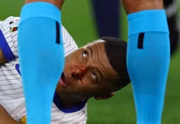 Chùm ảnh: Mbappe gãy xương mũi, phải đeo mặt nạ ở EURO 2024 