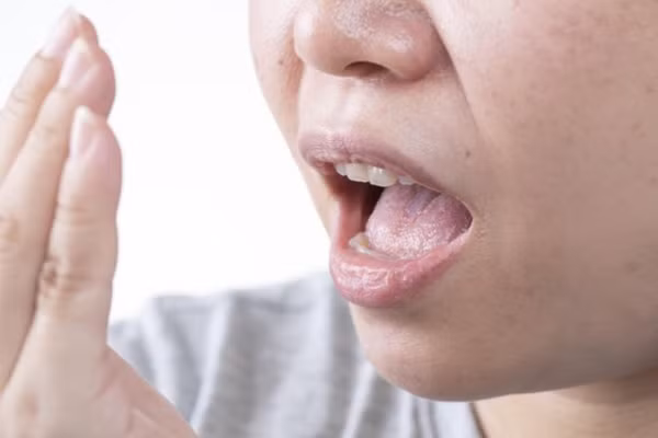 Hôi miệng, niêm mạc miệng nhợt nhạt cũng là tín hiệu cảnh báo về thận. (Ảnh: ITN)