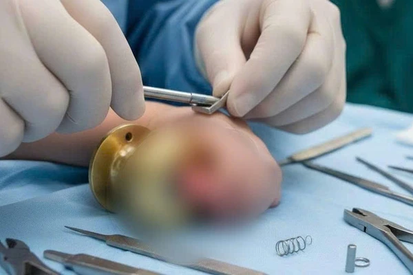 Phụ huynh, bảo mẫu, các trường mẫu giáo cần giám sắt trẻ chặt chẽ trong mọi hoạt động. (Ảnh minh họa)