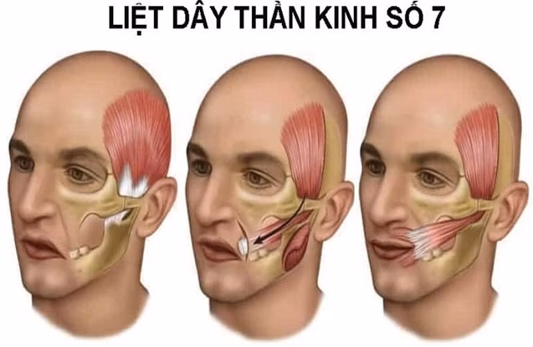 Minh họa/INT
