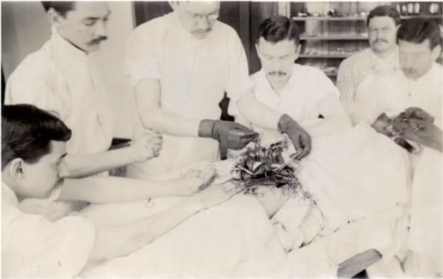 Một bác sĩ đeo găng tay cao su trong ca mổ vào năm 1893. 