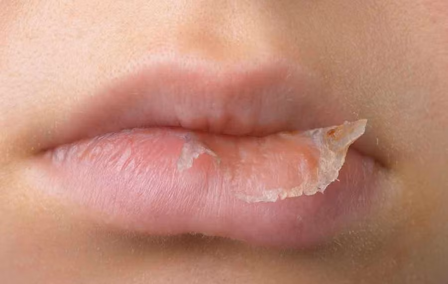 4 vùng da trên cơ thể rất dễ bị khô nhưng lại ít được quan tâm đến và cách dưỡng ẩm chúng hiệu quả - Ảnh 2.