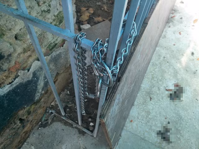 Lời kể đầy ám ảnh của cụ bà bị chó dữ tấn công phải nhập viện ở Hà Nội - Ảnh 4.
