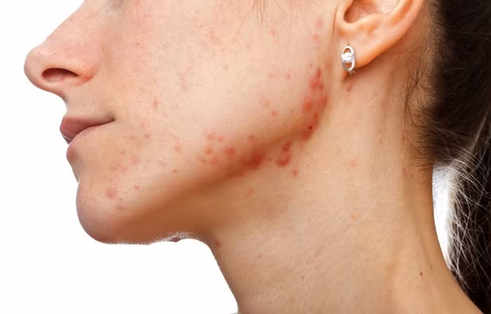 Không phải ai cũng biết 10 dấu hiệu cảnh báo sức khỏe gặp nguy để bảo vệ mình