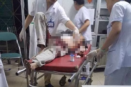 Hai nạn nhân đang được cấp cứu trong tình trạng nguy kịch. Ảnh: TP