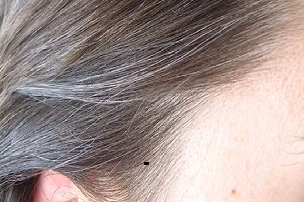 5 nốt ruồi cát tường, ai sở hữu cả đời không lo cơm áo gạo tiền ảnh 3
