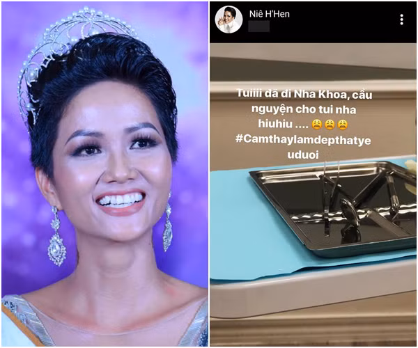 Các nàng hậu Việt sau khi từ bỏ răng khểnh, nhan sắc sẽ đi về đâu?