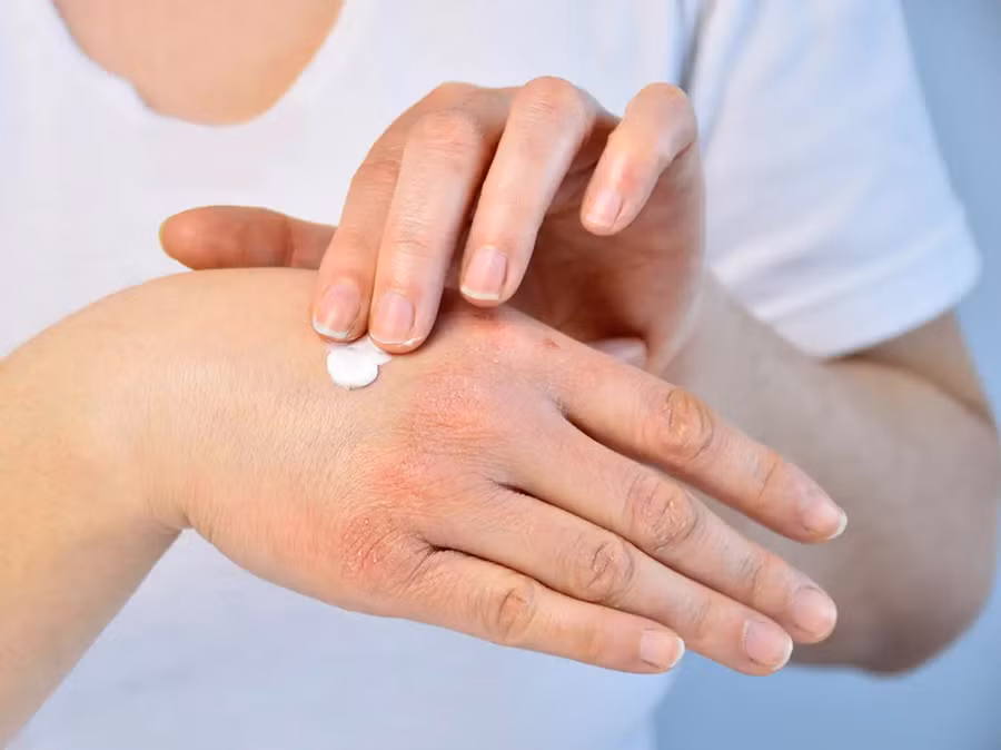 Khi chọn kem dưỡng ẩm cho mặt và cơ thể, hãy chọn loại lành tính nhất có thể. (Ảnh: ITN) Khi chọn kem dưỡng ẩm cho mặt và cơ thể, hãy chọn loại lành tính nhất có thể. (Ảnh: ITN)