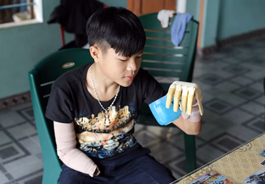 Những ngày đầu mới lắp cánh tay robot, Phan Trọng Hiếu đã có thể tự cầm nắm một số đồ vật với kích thước và trọng lượng khác nhau. Trong ảnh: Hiếu đang tự bê cốc nước để uống.