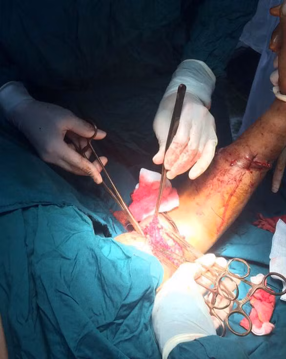 Các y, bác sĩ đang tiến hành phẫu thuật cho ngư dân gặp nạn