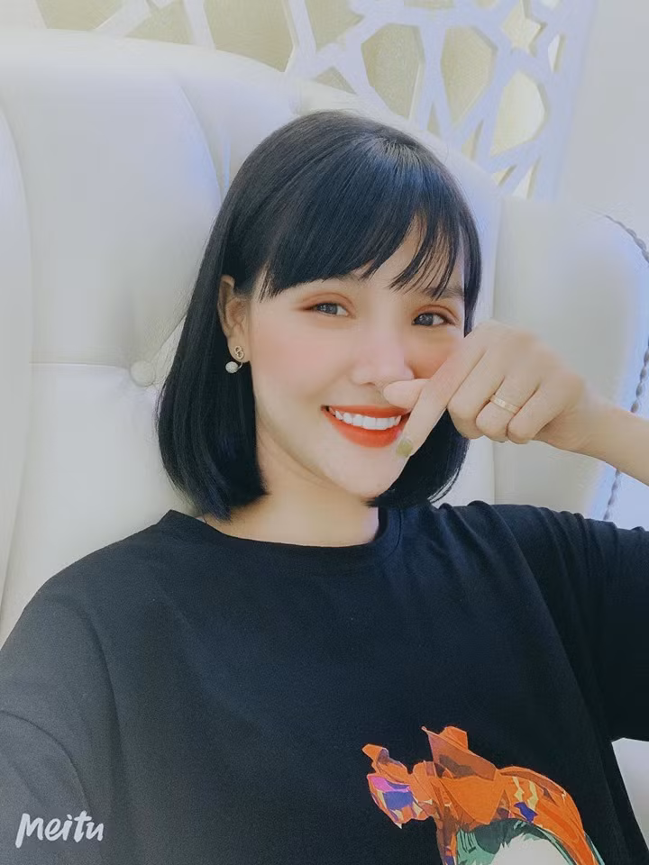 Tưởng cắt chỉ thẩm mỹ xong sẽ xinh đẹp hơn, ai dè gương mặt Kỳ Hân lại bị chê đơ như cây cơ-4