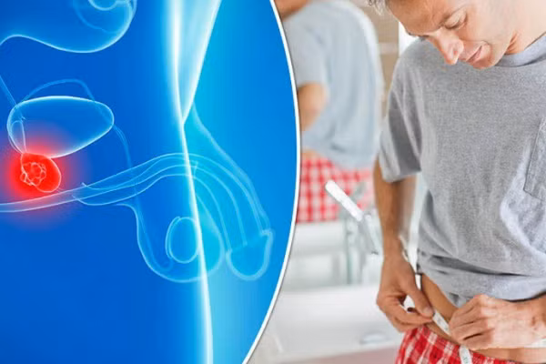 Đi tiểu có 3 dấu hiệu này, nam giới đi khám ngay kẻo ung thư tuyến tiền liệt ảnh 1 Empty
