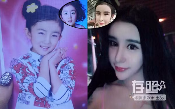 Lý Ân Hy cũng là một trường hợp gây nhiều tiếc nuối, bởi từ một cô gái nhí nhảnh, cô trở nên kém tự nhiênvì chạy theo mốt mắt to, cằm V-line. anh-qua-khu-gay-ngac-nhien-cua-cac-tham-hoa-cbiz-5